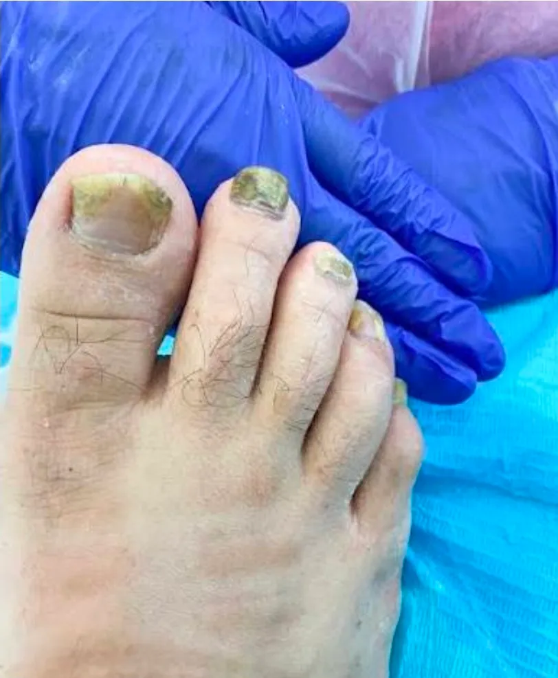 Pedicura clásica